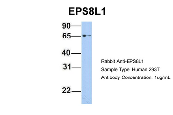 EPS8L1 Rabbit Polyclonal Antibody