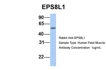 EPS8L1 Rabbit Polyclonal Antibody