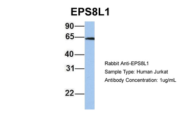 EPS8L1 Rabbit Polyclonal Antibody