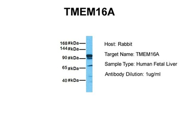 TMEM16A Rabbit Polyclonal Antibody