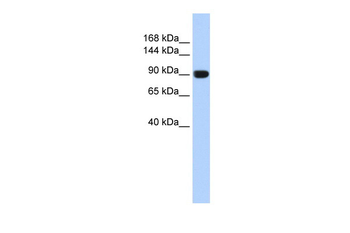 TMEM16A Rabbit Polyclonal Antibody