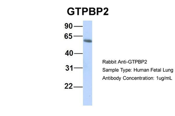 GTPBP2 Rabbit Polyclonal Antibody