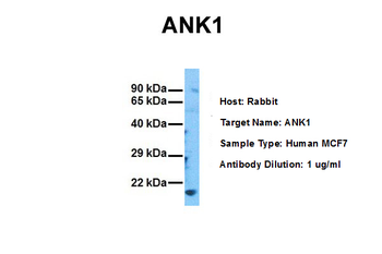 ANK1 Rabbit Polyclonal Antibody