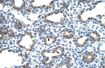 ANK1 Rabbit Polyclonal Antibody