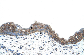 ANK1 Rabbit Polyclonal Antibody