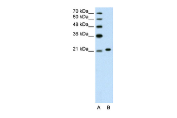 ANK1 Rabbit Polyclonal Antibody