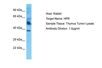HPR Rabbit Polyclonal Antibody