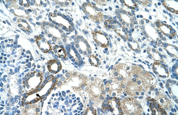 PSG3 Rabbit Polyclonal Antibody