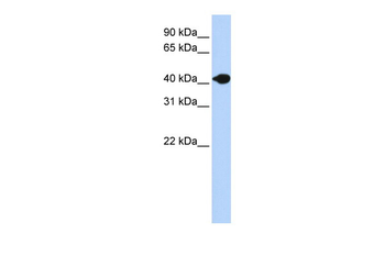 DNASE2B Rabbit Polyclonal Antibody