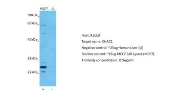 CHAC1 Rabbit Polyclonal Antibody