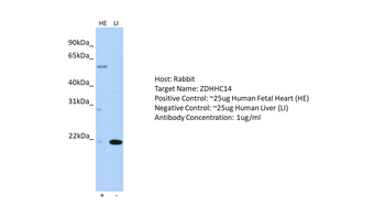 ZDHHC14 Rabbit Polyclonal Antibody