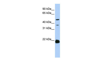 ZDHHC14 Rabbit Polyclonal Antibody