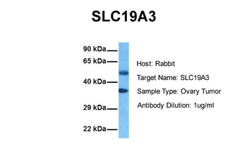 SLC19A3 Rabbit Polyclonal Antibody