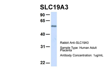 SLC19A3 Rabbit Polyclonal Antibody