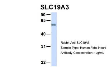 SLC19A3 Rabbit Polyclonal Antibody