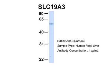 SLC19A3 Rabbit Polyclonal Antibody