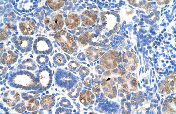 C5orf4 Rabbit Polyclonal Antibody
