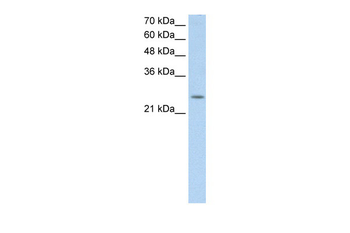 C5orf4 Rabbit Polyclonal Antibody