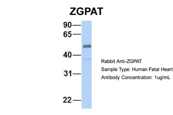 ZGPAT Rabbit Polyclonal Antibody