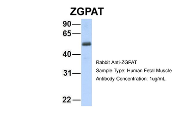 ZGPAT Rabbit Polyclonal Antibody