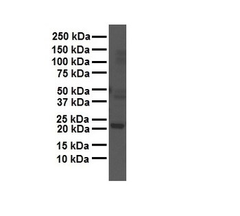 GAMT Rabbit Polyclonal Antibody