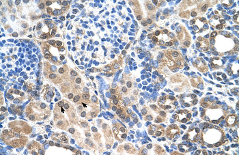 SLC22A7 Rabbit Polyclonal Antibody