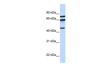 PPP4R2 Rabbit Polyclonal Antibody