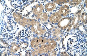 PLPP1 Rabbit Polyclonal Antibody