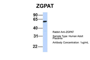 ZGPAT Rabbit Polyclonal Antibody
