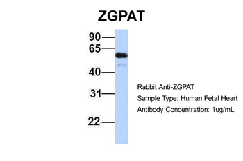 ZGPAT Rabbit Polyclonal Antibody