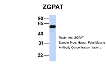 ZGPAT Rabbit Polyclonal Antibody