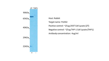 PLOD2 Rabbit Polyclonal Antibody