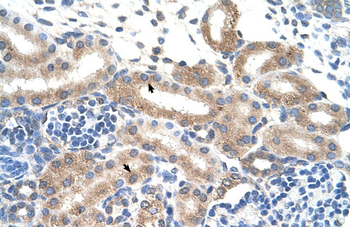 FAM174B Rabbit Polyclonal Antibody