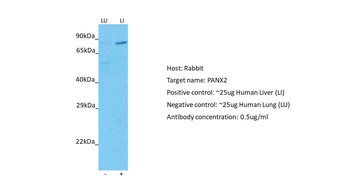 PANX2 Rabbit Polyclonal Antibody
