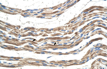 PANX2 Rabbit Polyclonal Antibody