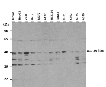 HDAC11 Rabbit Polyclonal Antibody