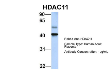 HDAC11 Rabbit Polyclonal Antibody