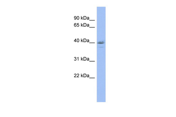 HDAC11 Rabbit Polyclonal Antibody