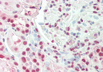 IRX3 Rabbit Polyclonal Antibody