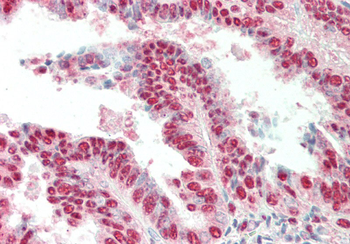 IRX3 Rabbit Polyclonal Antibody