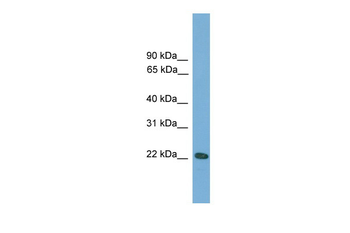 Rgs1 Rabbit Polyclonal Antibody