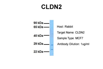 CLDN2 Rabbit Polyclonal Antibody