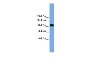 Parp8 Rabbit Polyclonal Antibody