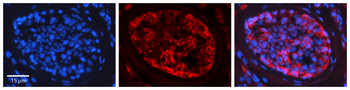 PRKCZ Rabbit Polyclonal Antibody