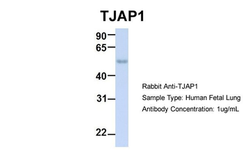 TJAP1 Rabbit Polyclonal Antibody