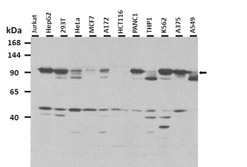 AMOTL1 Rabbit Polyclonal Antibody