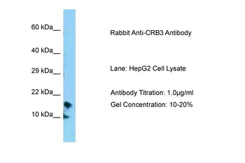 CRB3 Rabbit Polyclonal Antibody