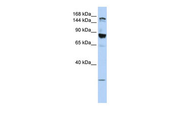 TJP2 Rabbit Polyclonal Antibody