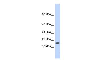 HERC4 Rabbit Polyclonal Antibody