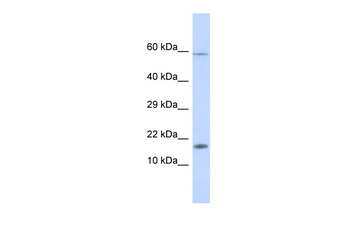HERC4 Rabbit Polyclonal Antibody